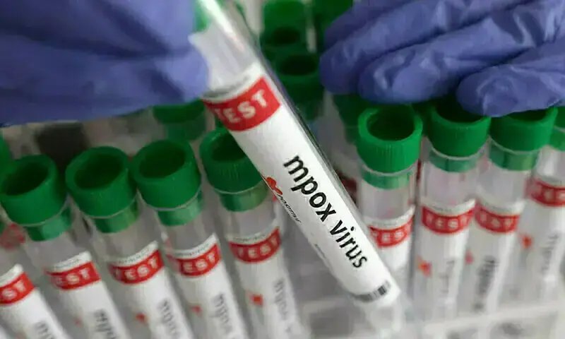 Mpox tally rises to 36 in Sindh as another man tests positive