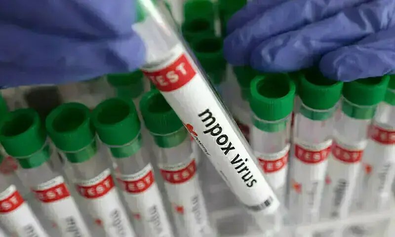 Young man tests positive for mpox in Karachi